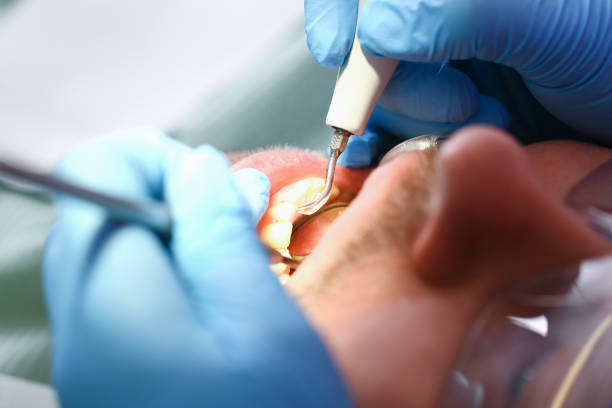 Best Tooth Infection Emergency Dentist  in St John, KS