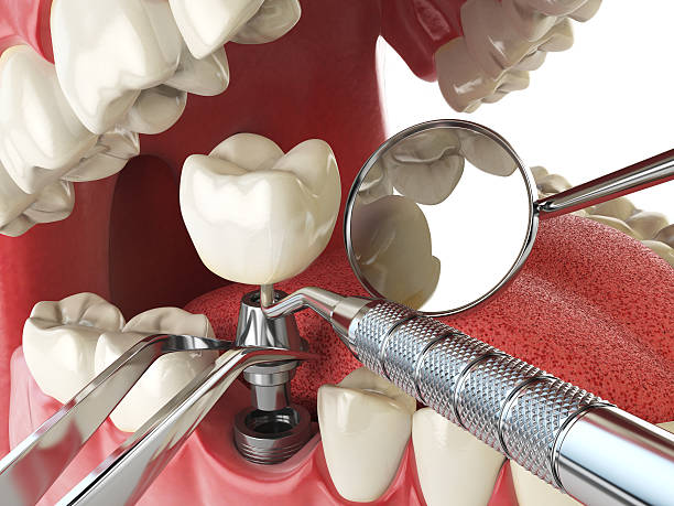 Best Knocked-Out Tooth Emergency  in St John, KS